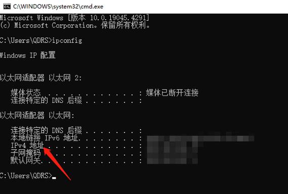 ipconfig显示媒体已断开